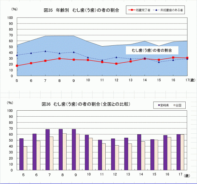 むし歯（う歯）